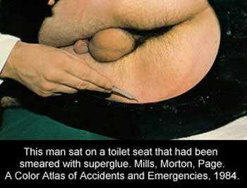 Toiletseat